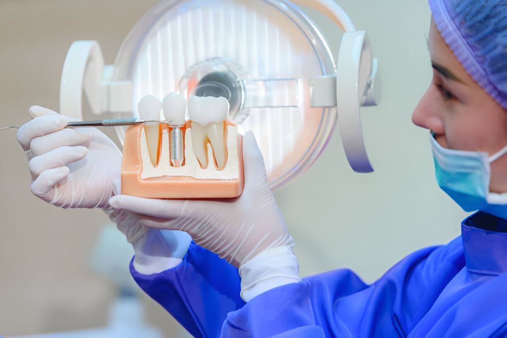 dental implants applebay family dental niagara falls